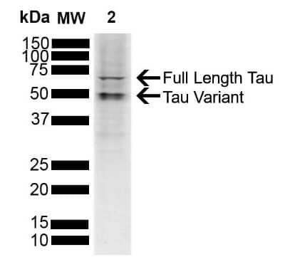 Western Blot: Tau Antibody [NBP3-18237] - Western blot analysis of SH-SY5Y showing detection of ~45.8 kDa Tau protein using Rabbit Anti-Tau Polyclonal Antibody (NBP3-18237). Lane 1: Molecular Weight Ladder (MW). Lane 2:  SH-SY5Y. Load: 10 ug. Block: 5% Skim Milk powder in TBST. Primary Antibody: Rabbit Anti-Tau Polyclonal Antibody (NBP3-18237) at 1:1000 for 2 hours at RT with shaking. Secondary Antibody: Goat anti-rabbit IgG:HRP at 1:4000 for 1 hour at RT with shaking. Color Development: Chemiluminescent for HRP (Moss) for 5 min in RT. Predicted/Observed Size: ~45.8 kDa. Other Band(s): 50 kDa, 65 kDa.